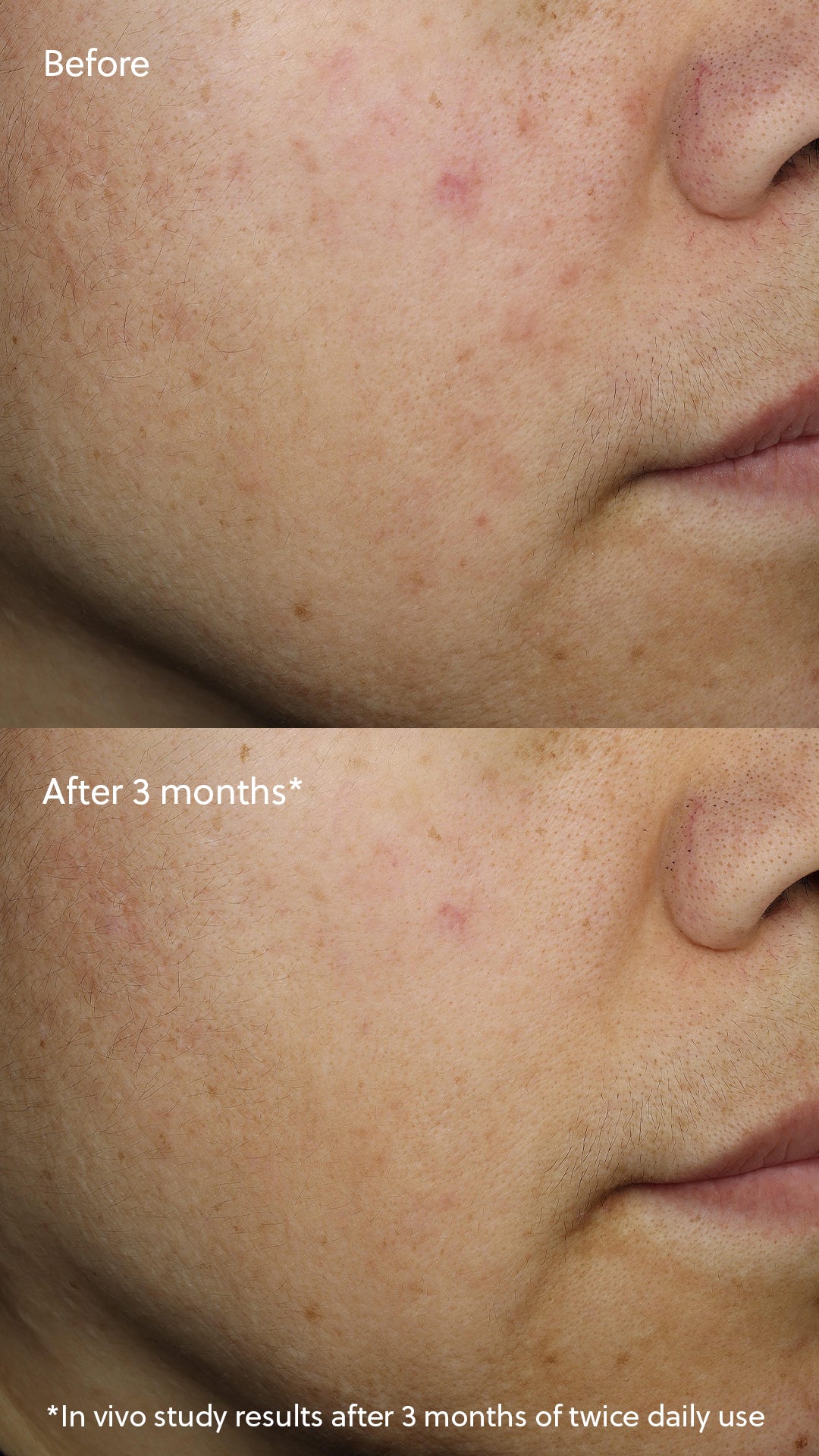 Vitamin C+ Serum-thumbmail-6